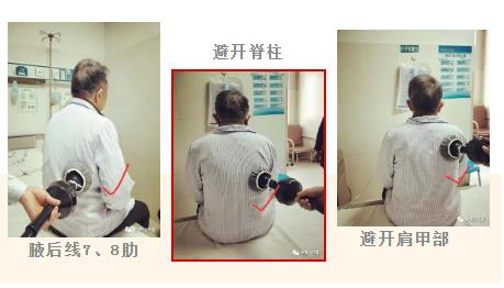 排痰機(jī)排痰，這些知識(shí)點(diǎn)你都了解嗎？